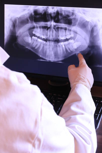 Best Emergency Wisdom Teeth Removal in Shattuck, OK