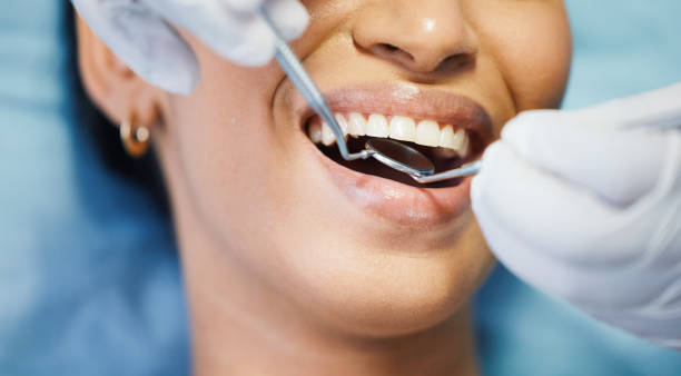 Best Same-Day Emergency Dental Services in Shattuck, OK