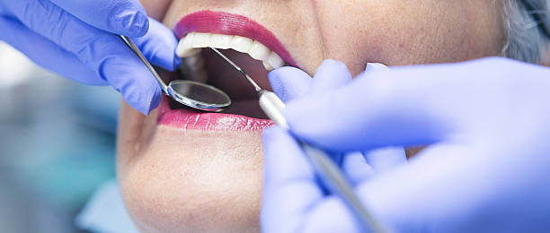 Best Urgent Care for Lost Fillings or Crowns in Shattuck, OK